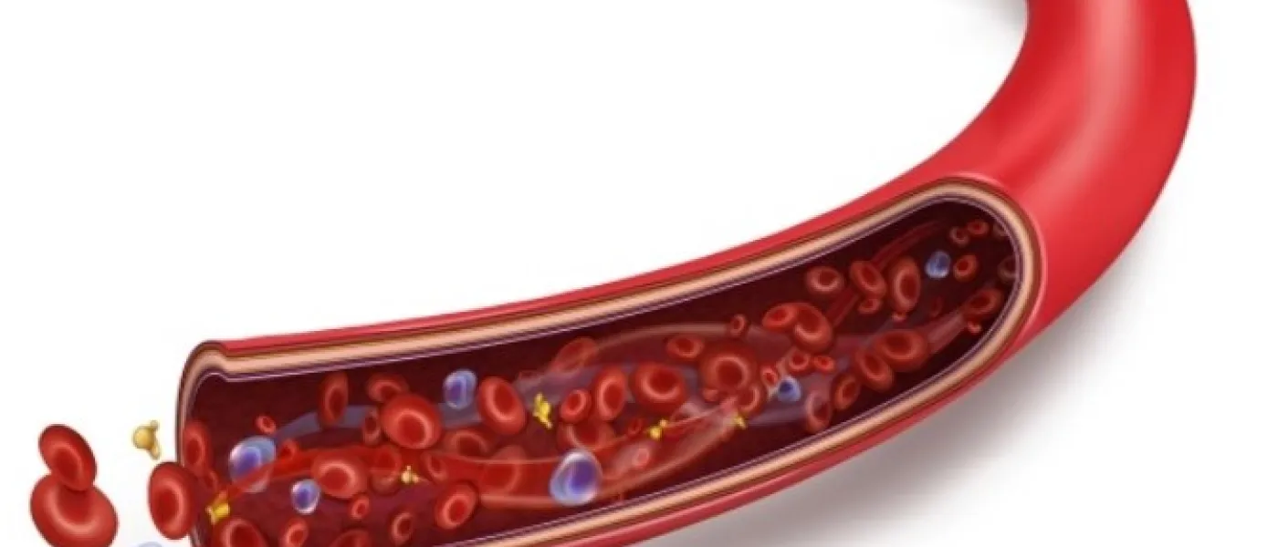 Colesterolo e arteriosclerosi