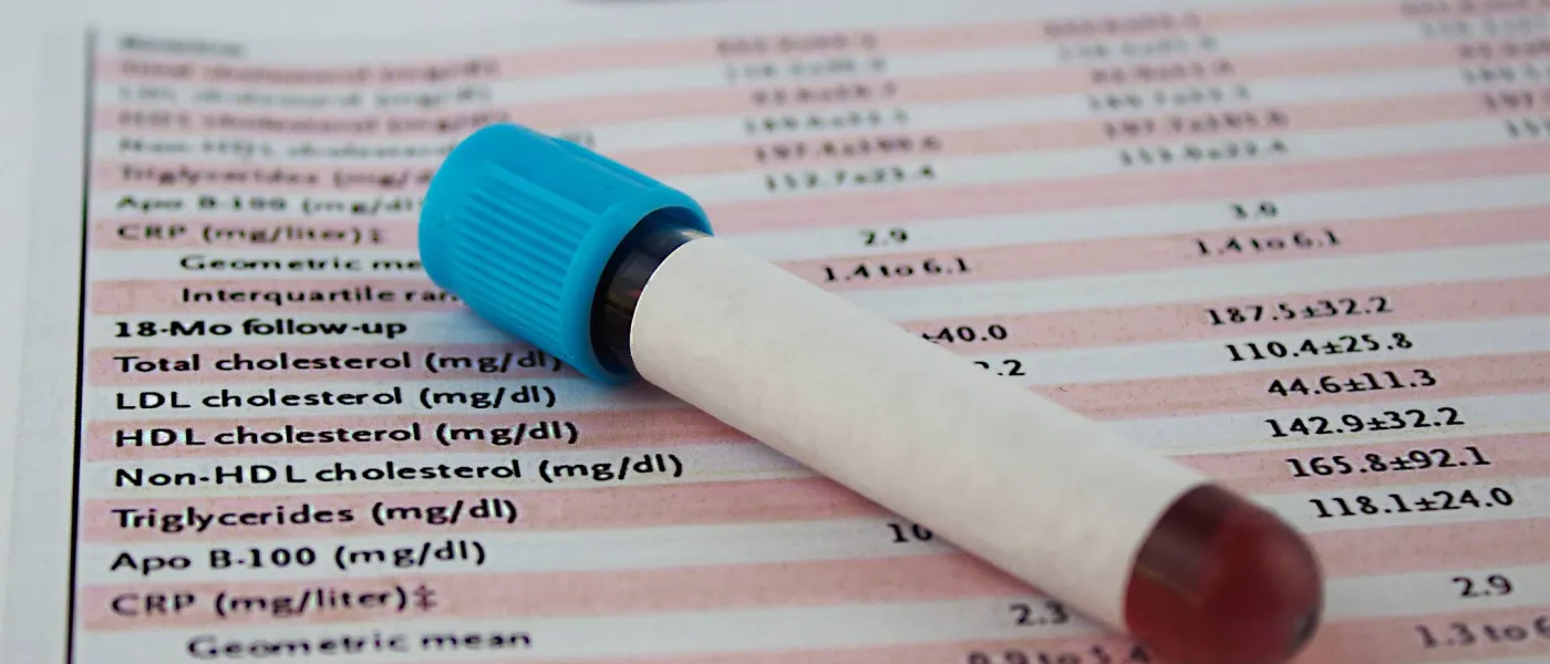 Calcolo del colesterolo LDL: come determinarlo e interpretare i valori