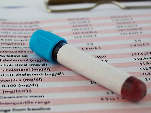 Calcolo del colesterolo LDL: come determinarlo e interpretare i valori